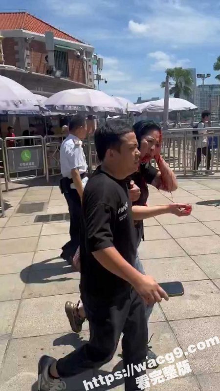 突发事件！厦门一对夫妻从思明区法院鼓浪屿分院办理离婚后 丈夫突然从包里拿出折叠刀捅向妻子头部-51吃瓜网