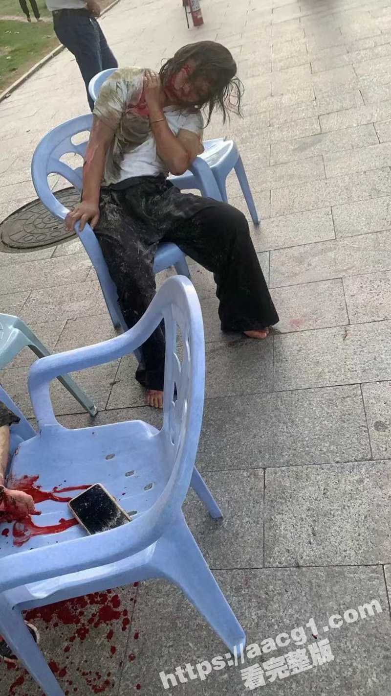 福建漳州云霄县惊现疯狂司机 车内纵火驶向校门口致多名学生受伤 现场一片血肉横飞惨象 - 51吃瓜网-51吃瓜网